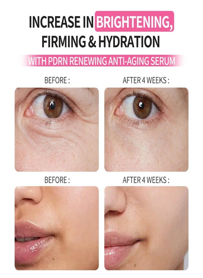 Morovan Salmon DNA PDRN Serum for Face: 99% PDRN Anti-Aging Ampoule with Collagen, Hyaluronic, Glutathione Hydrating & Firming Solution for Skin, Daily Use & Emergency Moisture, 20 x 1.0 oz - Image 4